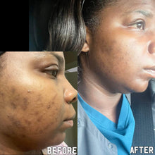 Load image into Gallery viewer, Increasing One Natural Face Serum